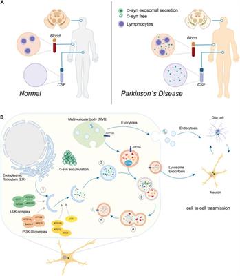 Contribution of Autophagy-Lysosomal Pathway in the Exosomal Secretion of Alpha-Synuclein and Its Impact in the Progression of Parkinson’s Disease